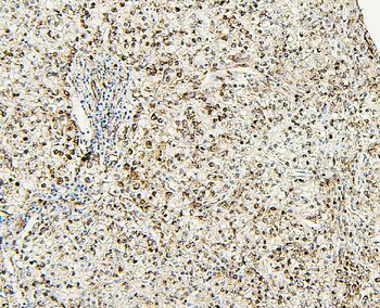 PXR/NR1I2 Rabbit Polyclonal Antibody