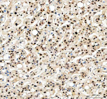 PCNA Antibody