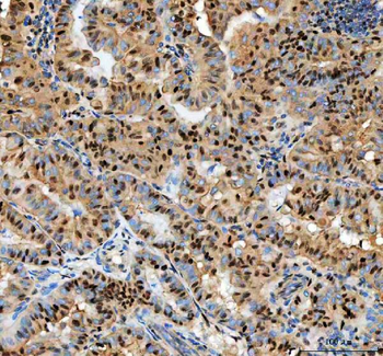 PCNA Antibody