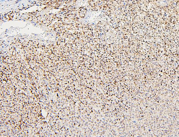 Polycystin 2/PKD2 Rabbit Polyclonal Antibody