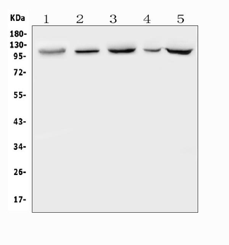Polycystin 2/PKD2 Rabbit Polyclonal Antibody
