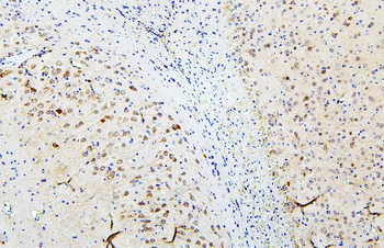 SKP1 Antibody