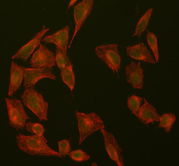 SUZ12 Rabbit Polyclonal Antibody