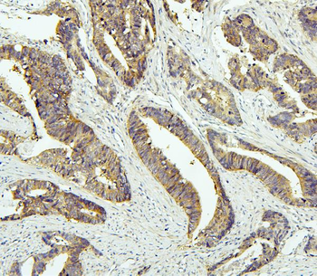 Tafazzin/TAZ Antibody