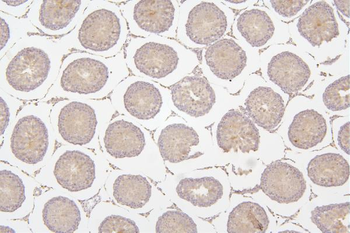 Tafazzin/TAZ Antibody