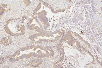 Tafazzin/TAZ Antibody