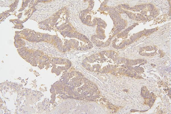 Tafazzin/TAZ Antibody