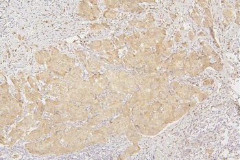 Tafazzin/TAZ Antibody