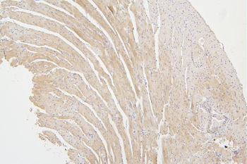 Tafazzin/TAZ Antibody