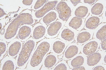 Tafazzin/TAZ Antibody