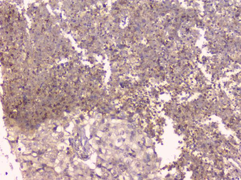 Osteoprotegerin/TNFRSF11B Antibody