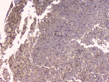 Osteoprotegerin/TNFRSF11B Antibody