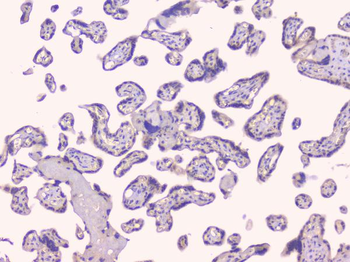 Osteoprotegerin/TNFRSF11B Antibody