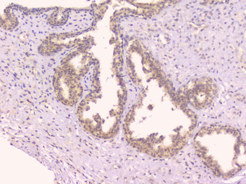 Osteoprotegerin/TNFRSF11B Antibody