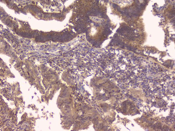 Osteoprotegerin/TNFRSF11B Antibody