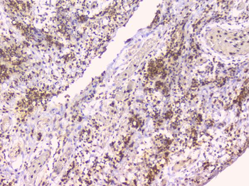 Osteoprotegerin/TNFRSF11B Antibody