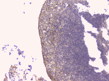 Osteoprotegerin/TNFRSF11B Antibody