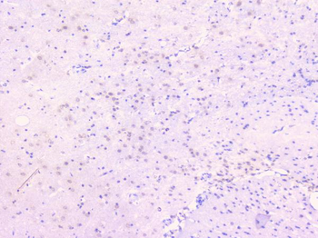 Osteoprotegerin/TNFRSF11B Antibody