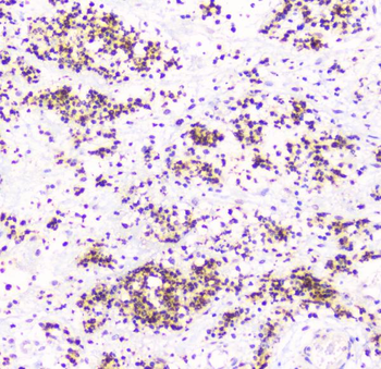 Osteoprotegerin/TNFRSF11B Antibody