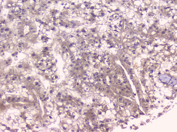 Osteoprotegerin/TNFRSF11B Antibody