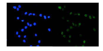 Topoisomerase II alpha/TOP2A Rabbit Polyclonal Antibody
