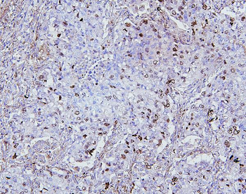 Topoisomerase II alpha/TOP2A Rabbit Polyclonal Antibody