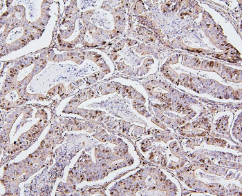 Topoisomerase II alpha/TOP2A Rabbit Polyclonal Antibody