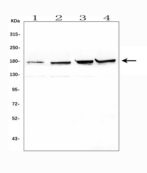 Topoisomerase II alpha/TOP2A Rabbit Polyclonal Antibody
