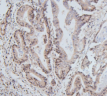 UBE2I/UBC9 Antibody