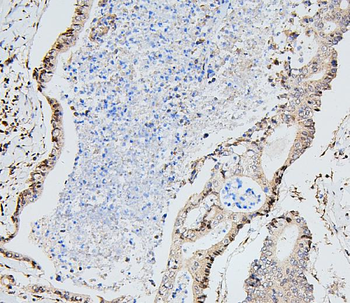 UBE2I/UBC9 Antibody
