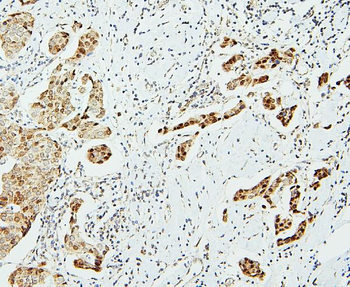 UBE2I/UBC9 Antibody