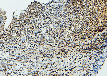 UBE2I/UBC9 Antibody