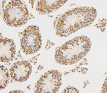 UBE2I/UBC9 Antibody