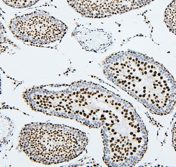 UBE2I/UBC9 Antibody