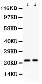 Interleukin-18 IL18/18 Rabbit Polyclonal Antibody
