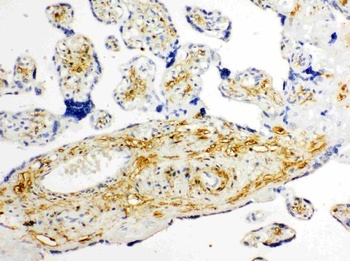 Glucose Transporter 8/SLC2A8 Rabbit Polyclonal Antibody