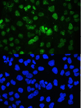 YY1 Rabbit Polyclonal Antibody