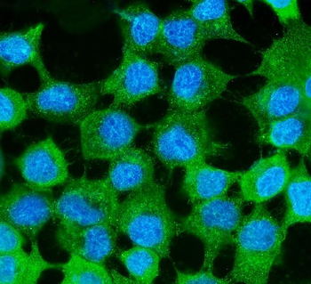 MVP Antibody (monoclonal, 8B12)