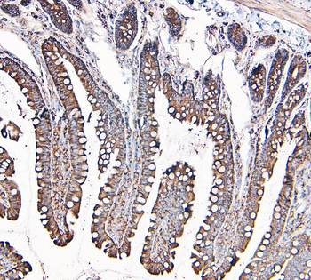 MVP Antibody (monoclonal, 8B12)