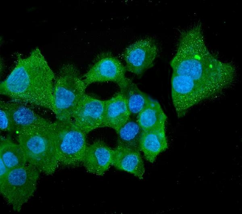 ALDH2 Mouse Monoclonal Antibody