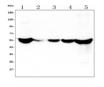 ALDH2 Mouse Monoclonal Antibody