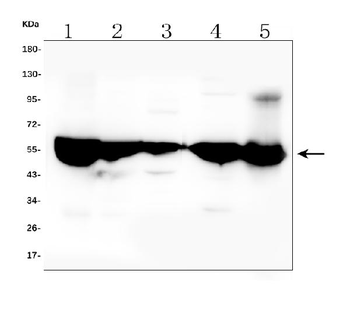 ALDH2 Mouse Monoclonal Antibody
