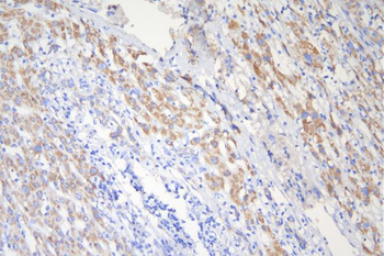 Tuberin TSC2 Mouse Monoclonal Antibody