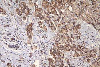 mtTFA TFAM Mouse Monoclonal Antibody
