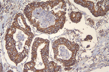 mtTFA TFAM Mouse Monoclonal Antibody