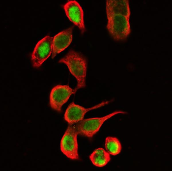 Beta Tubulin TUBB Antibody (monoclonal, 2E11)