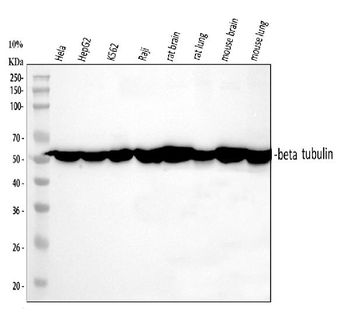 Beta Tubulin TUBB Antibody (monoclonal, 2E11)