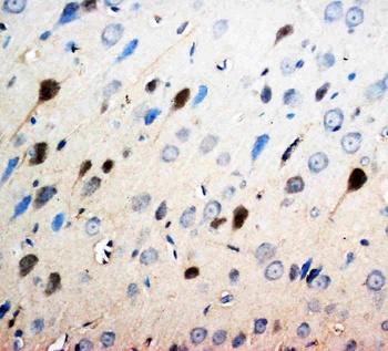 Neurotrophin 3/NTF3 Rabbit Polyclonal Antibody