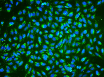 ALDH2 Mouse Monoclonal Antibody