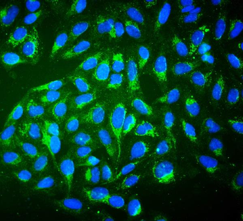 ALDH2 Mouse Monoclonal Antibody